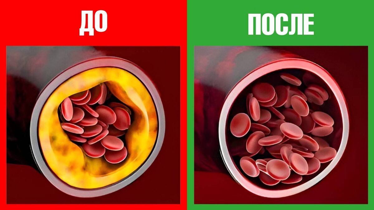 Секреты здоровья сердца: продукты, которые стоит добавить в рацион